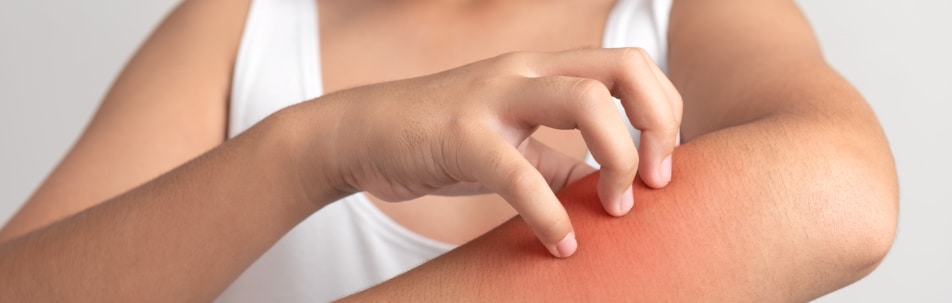 closeup image of person with contact dermatitis itching their arm