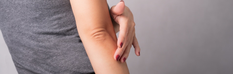 banner image of an elbow with eczema