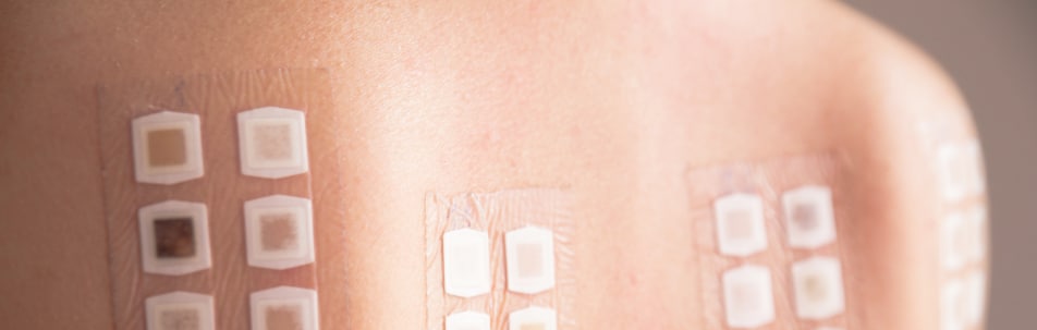image of a patient's skin while undergoing allergy testing