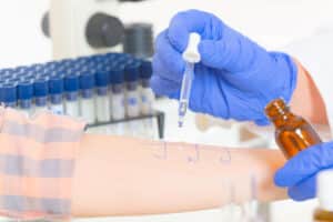 Medical doctor doing allergy tests in laboratory