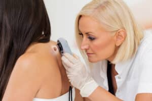 Female dermatologist examining female patient's skin with dermascope, doctor is carefully looking for signs of skin cancer