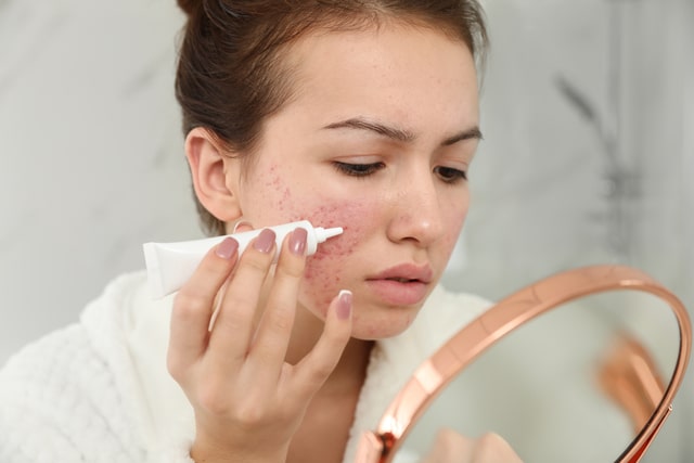 Teen girl with acne problem applying cream using mirror in bathroom