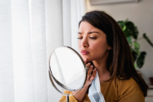 Woman looking at acne in the mirror